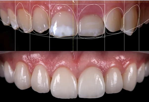 Cosmetic Dentistry