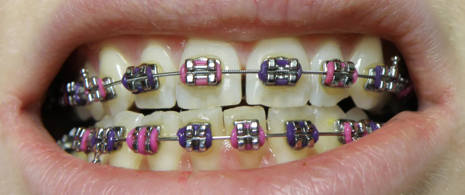 Orthodontics