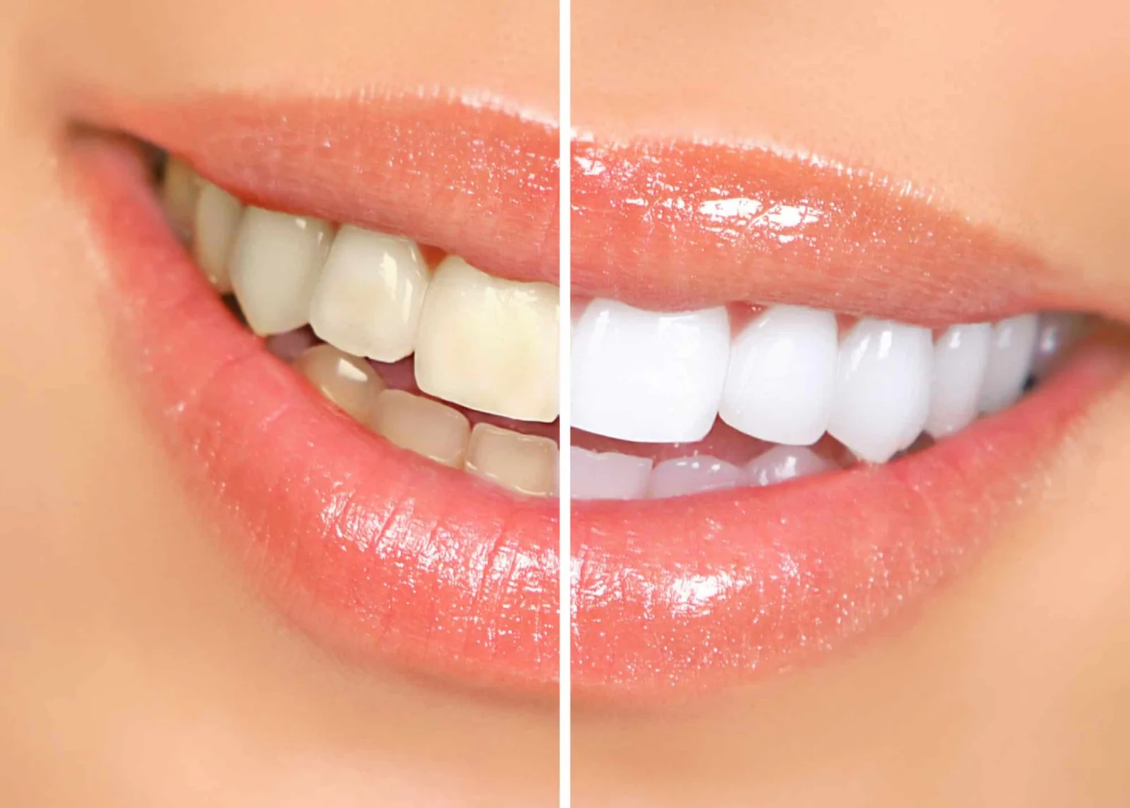 Scaling & Whitening